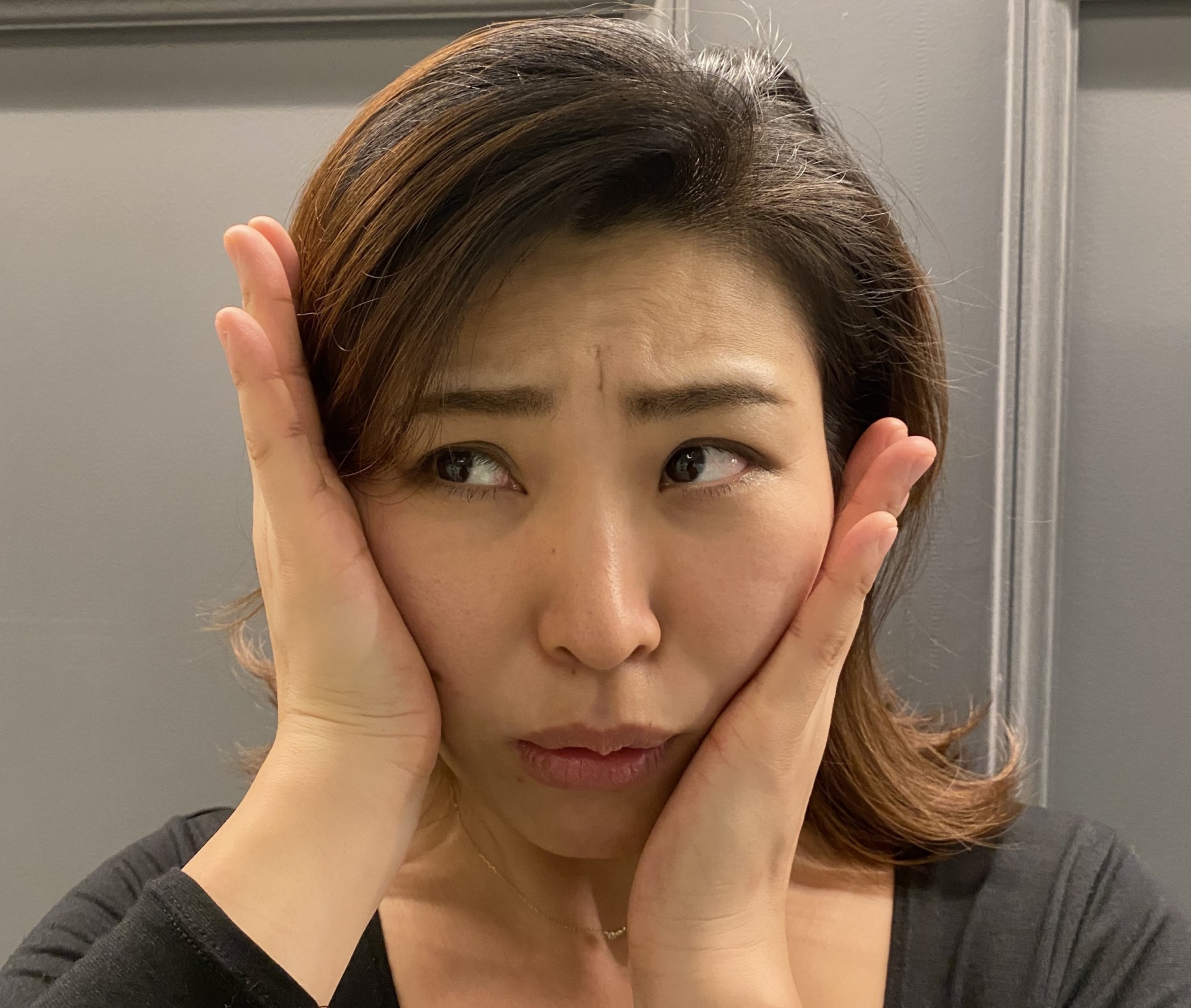 鍼でニキビが増えた 悪化してる プロが理由を解説します 神戸三宮美容鍼灸salon Make A Life