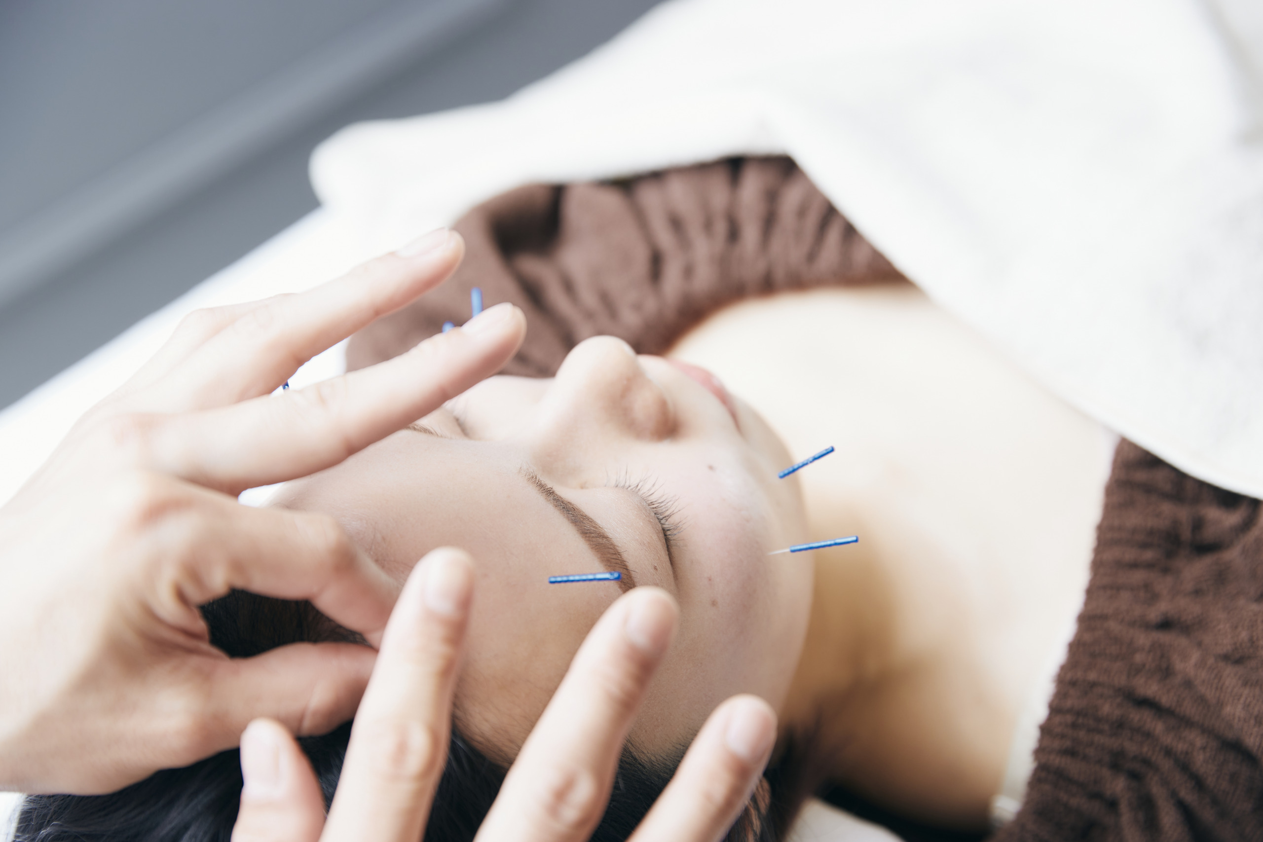 美容鍼の失敗例や危険性についてプロの鍼灸師が解説 神戸三宮美容鍼灸salon Make A Life