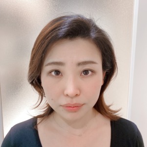 美容鍼でエラ張りや目の下のたるみが解消 リフトアップで小顔へ 神戸三宮美容鍼灸salon Make A Life